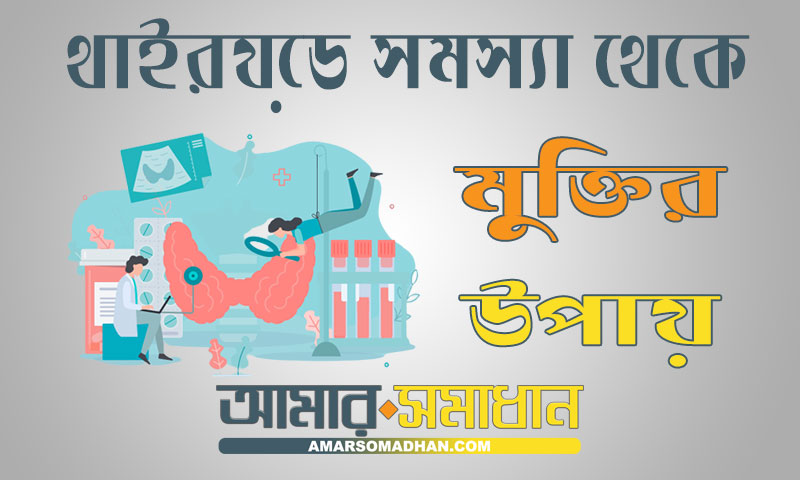 থাইরয়েড সমস্যা থেকে মুক্তির ঘরোয়া উপায়